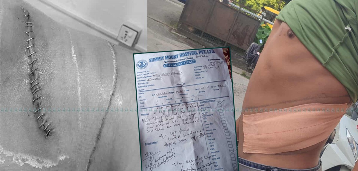भारतमा प्रलोभन देखाई मिर्गौला बेच्ने गिरोह, ५ पीडितको उजुरी