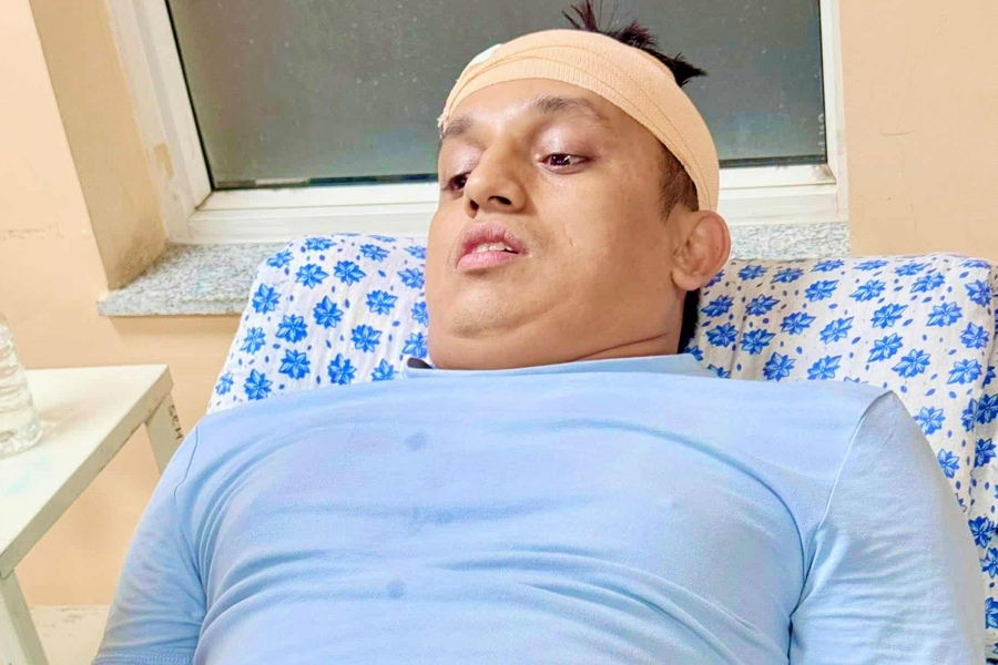 रास्वपा नेता बदन भण्डारीमाथि आक्रमण, गहिरो चोटसहित उपचारमा